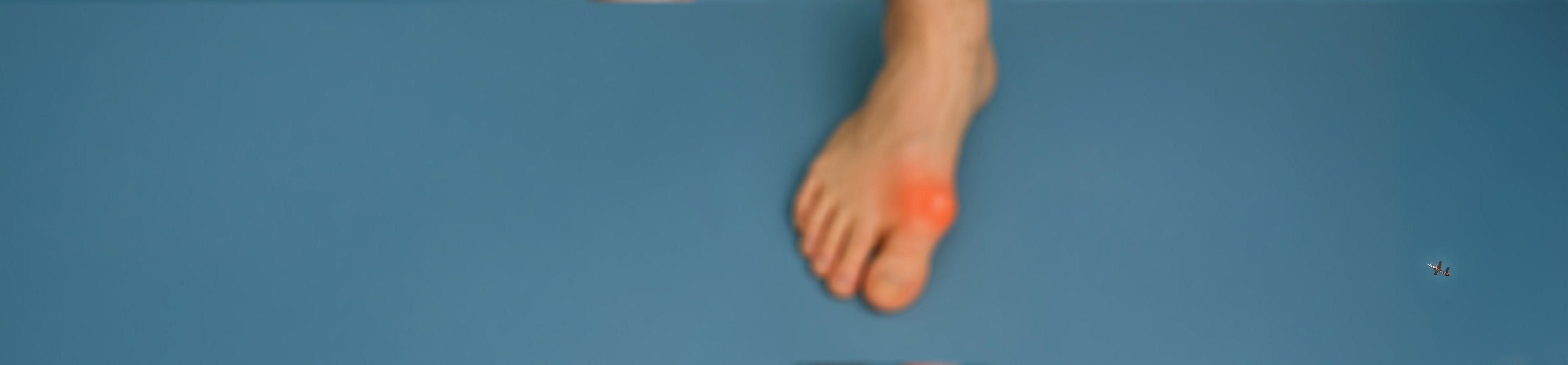 Shoes for Bunions